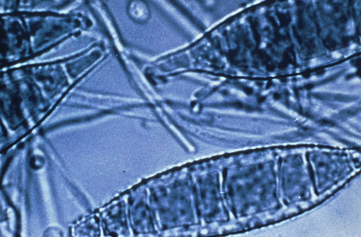 Microsporum canis, agent de la teigne microsporique, contractée à partir des chiens et chats domestiques. Dûe à un champignon dermatophyte dont la spore pénètre la couche cornée de la peau (kératine) puis envahit le poil ou le cheveu par un mycélium rubané. Teigne la plus commune, caractérisée par des plaques fluorescentes visibles aux rayons ultraviolets.