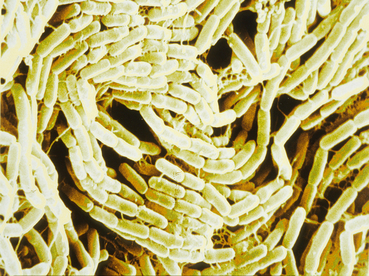 Bacillus thuringiensis. Bactérie, dont la toxine tue les moustiques ou les chenilles processionnaires du pin utilisée pour la lutte biologique contre les insectes. Vue en microscopie électronique à balayage. Image colorisée.